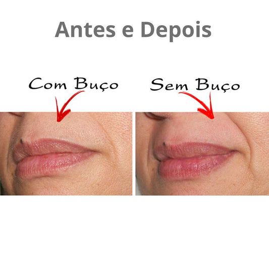 Mini Depilador Elétrico Buço Sobrancelha Nariz Virilha Axila Super