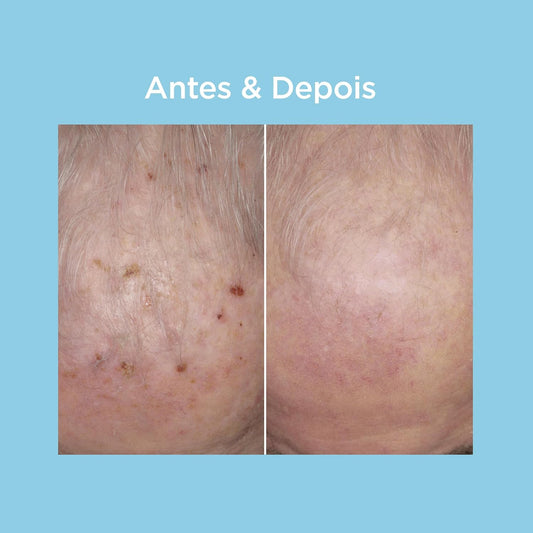 ISDIN Protetor Solar Facial Eryfotona AK-NMSC FPS 99-50ml