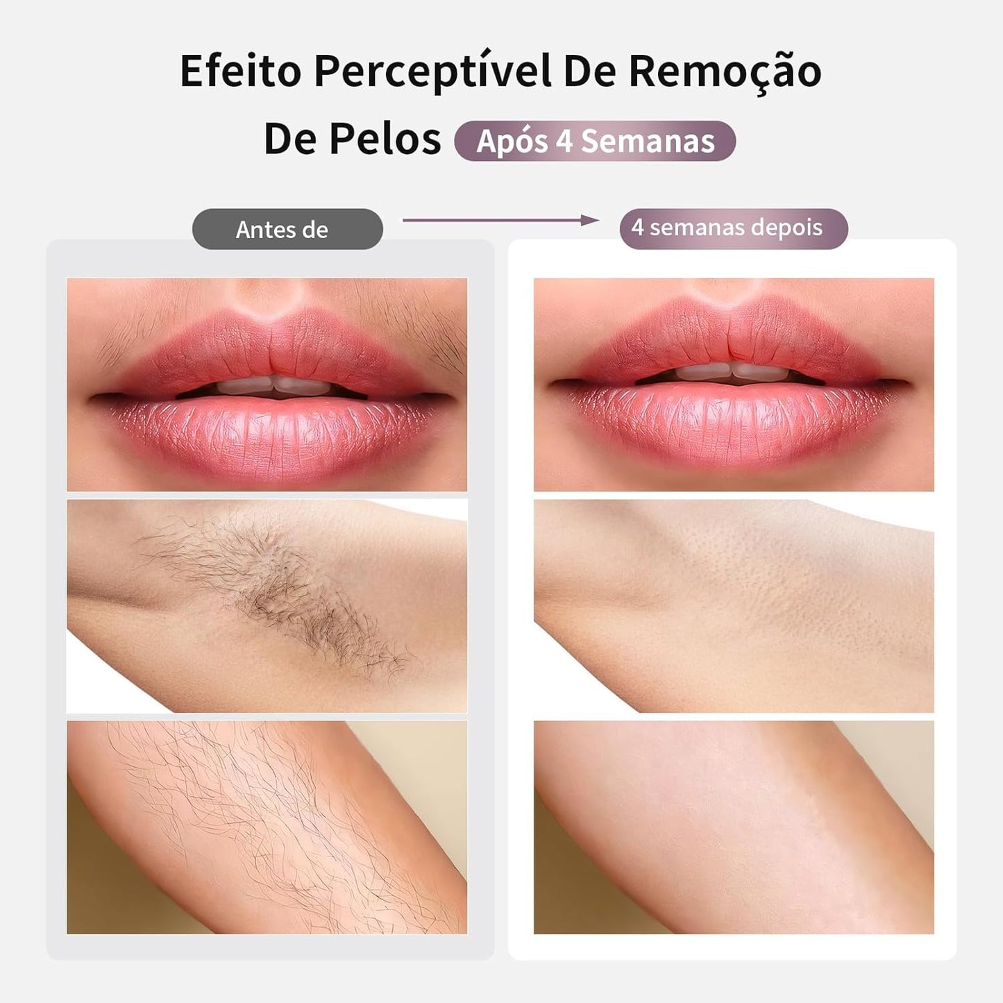 Depilador a Laser IPL MLAY T4 com Resfriamento, Aprovado pela ANVISA, Luz Pulsada para Uso Doméstico, Redução Visível de Pelos com Uso Contínuo, Unissex, para Rosto, Axilas e Corpo