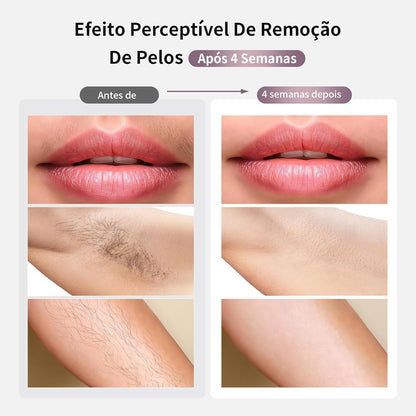 Depilador a Laser IPL MLAY T4 com Resfriamento, Aprovado pela ANVISA, Luz Pulsada para Uso Doméstico, Redução Visível de Pelos com Uso Contínuo, Unissex, para Rosto, Axilas e Corpo