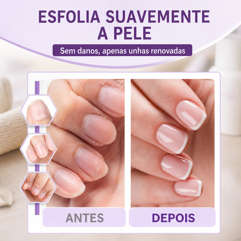 Caneta de Óleo de Cutícula 3 em 1 Empurrador de Unha Removedor de Pele Morta com Ponta de Cerâmica